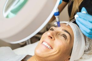 Nano Needling Vs Microneedling: What’s The Difference?