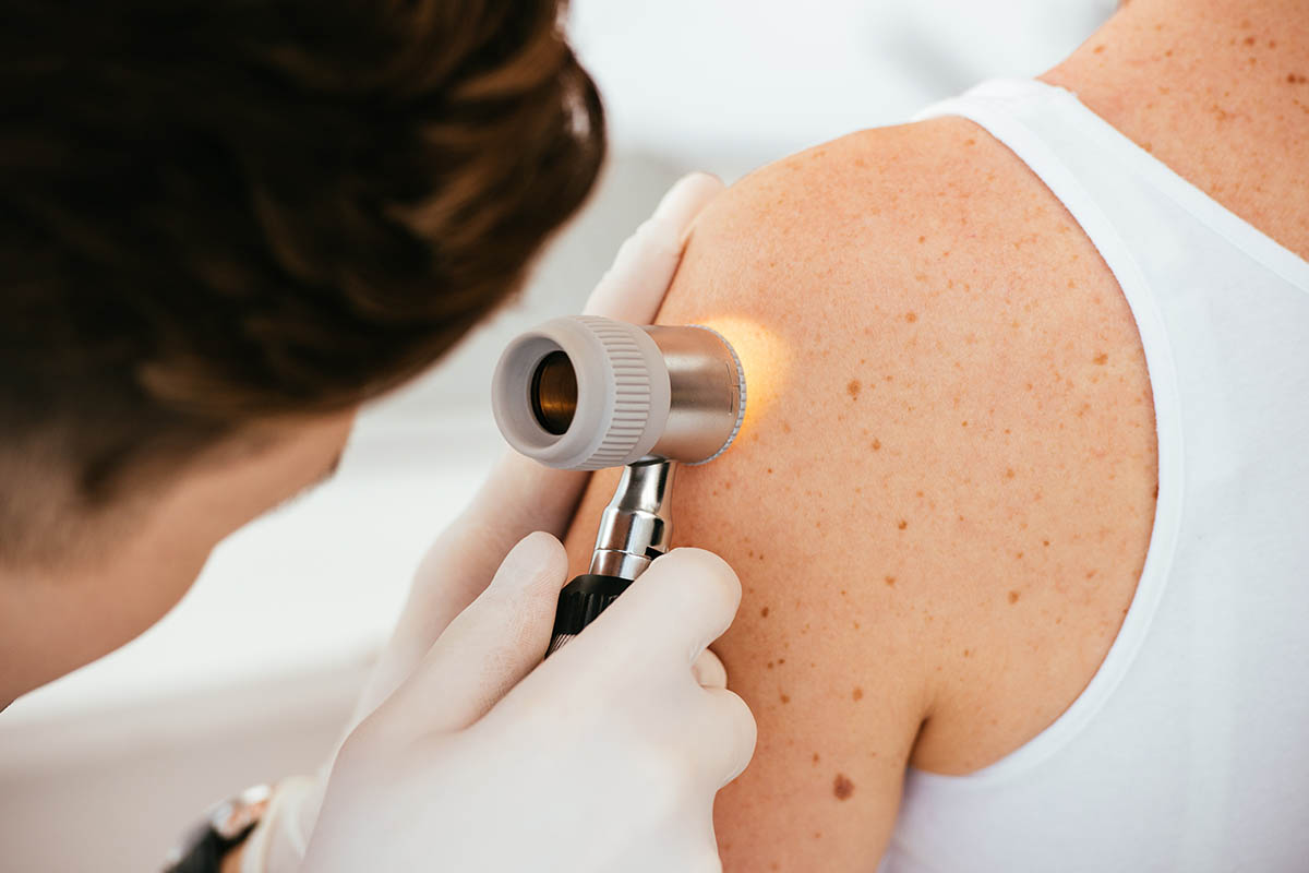 A woman receiving a laser treatment on her arm