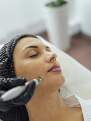 Skin Mole Removal