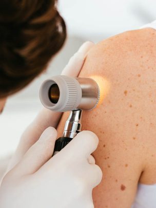 A woman receiving a laser treatment on her arm